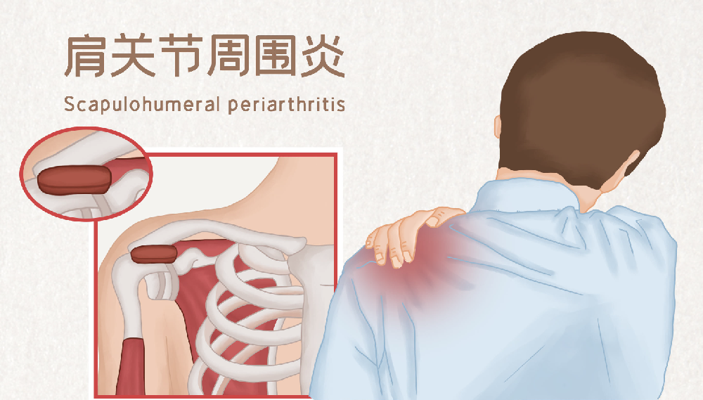 邵陽創(chuàng)傷骨科,邵陽風濕病區(qū),邵陽骨質增生,邵陽關節(jié)病區(qū),邵陽頸椎病區(qū)