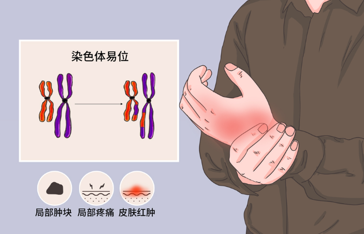 邵陽創(chuàng)傷骨科,邵陽風濕病區(qū),邵陽骨質增生,邵陽關節(jié)病區(qū),邵陽頸椎病區(qū)