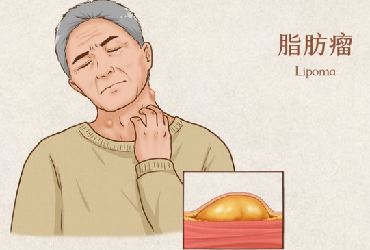 邵陽創(chuàng)傷骨科,邵陽風濕病區(qū),邵陽骨質增生,邵陽關節(jié)病區(qū),邵陽頸椎病區(qū)