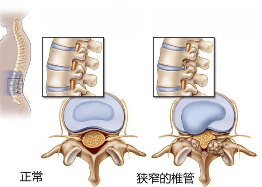 邵陽創(chuàng)傷骨科,邵陽風濕病區(qū),邵陽骨質(zhì)增生,邵陽關(guān)節(jié)病區(qū),邵陽頸椎病區(qū)